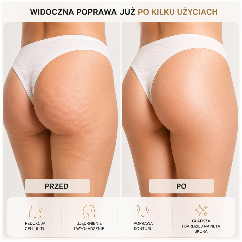 Pośladki — przed i po